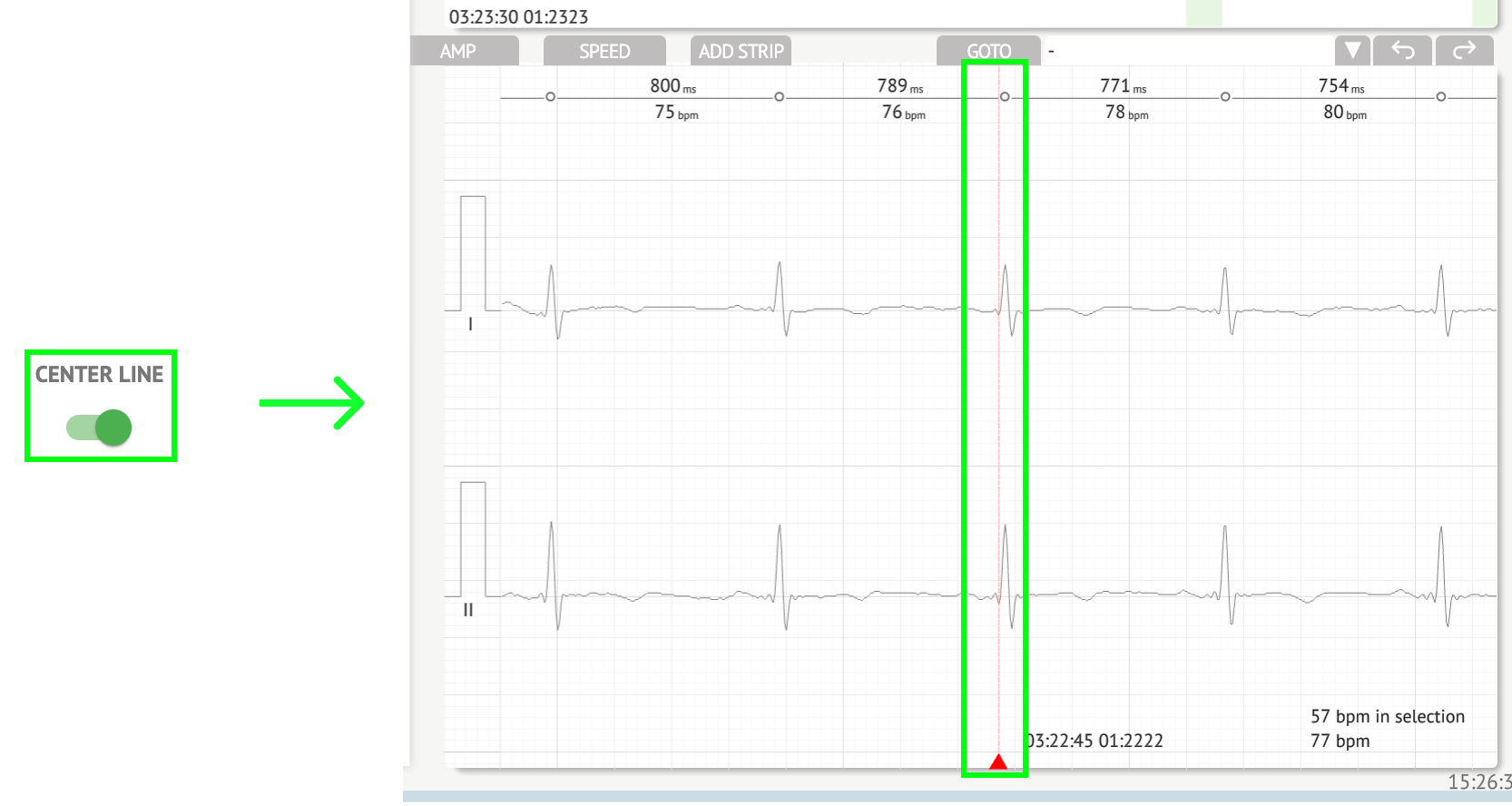 CardioAI Support. ECG data anal
ysing - image84